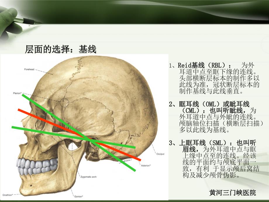 头颅CT 报告 解读_第3页