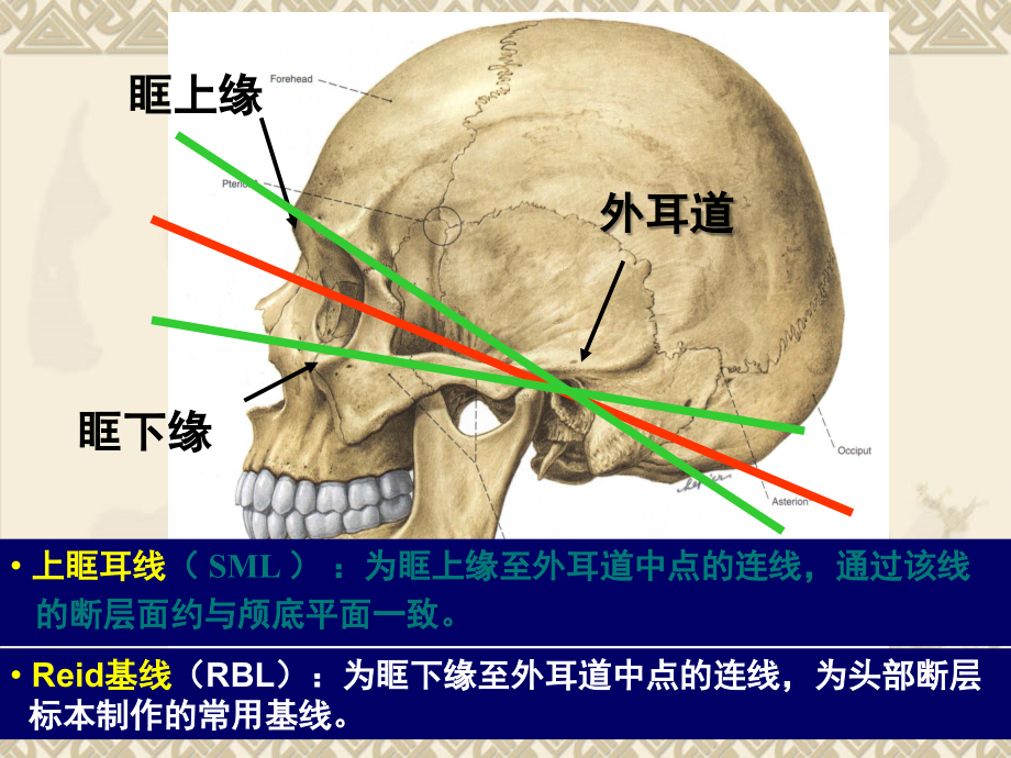 头颅CT与断层 解剖 对照_第4页