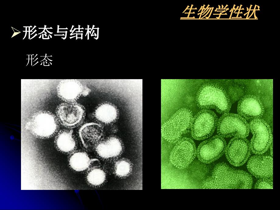 微生物与免疫学专科课件26章呼吸道病毒_第3页