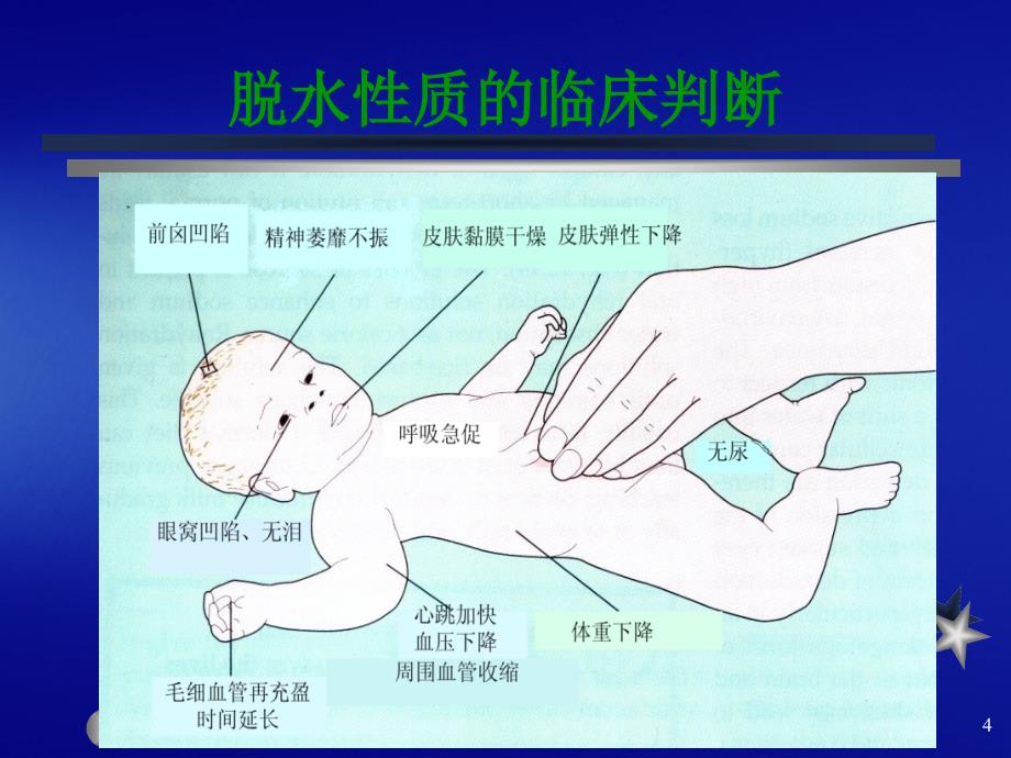 儿科学小儿腹泻病_第4页