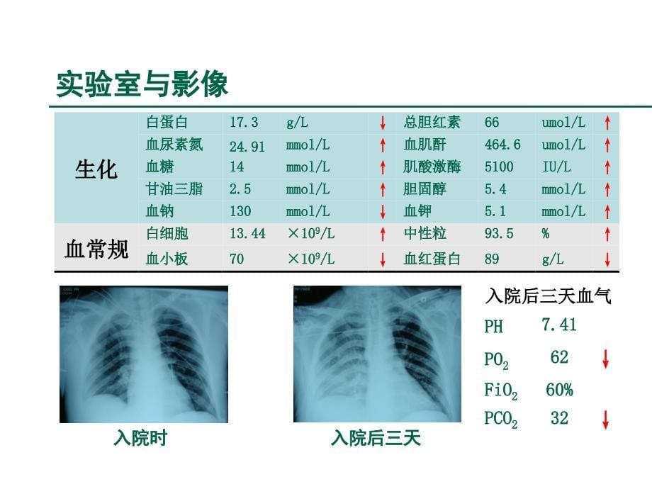 创伤后机体反应及生命支持_第5页