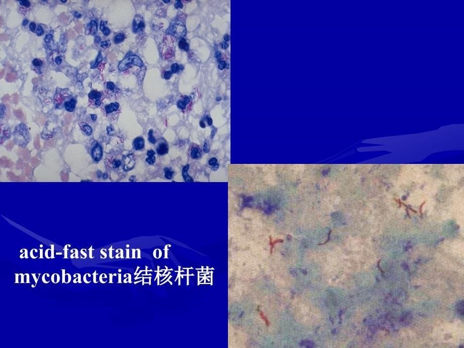 医学微生物学分枝杆菌属_第5页