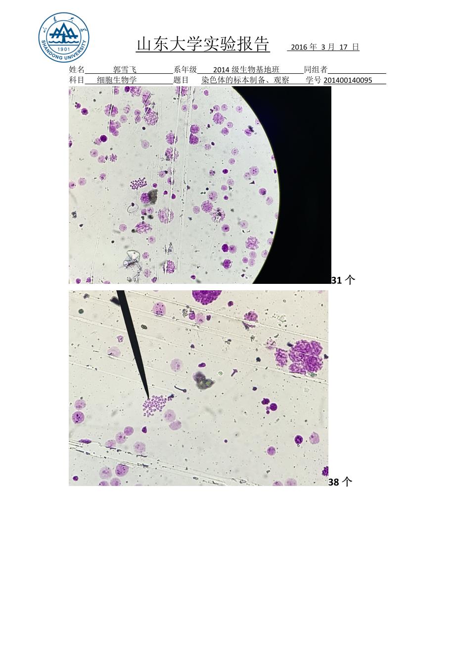 细胞生物学实验报告-染色体的观察---山东大学汇总_第3页