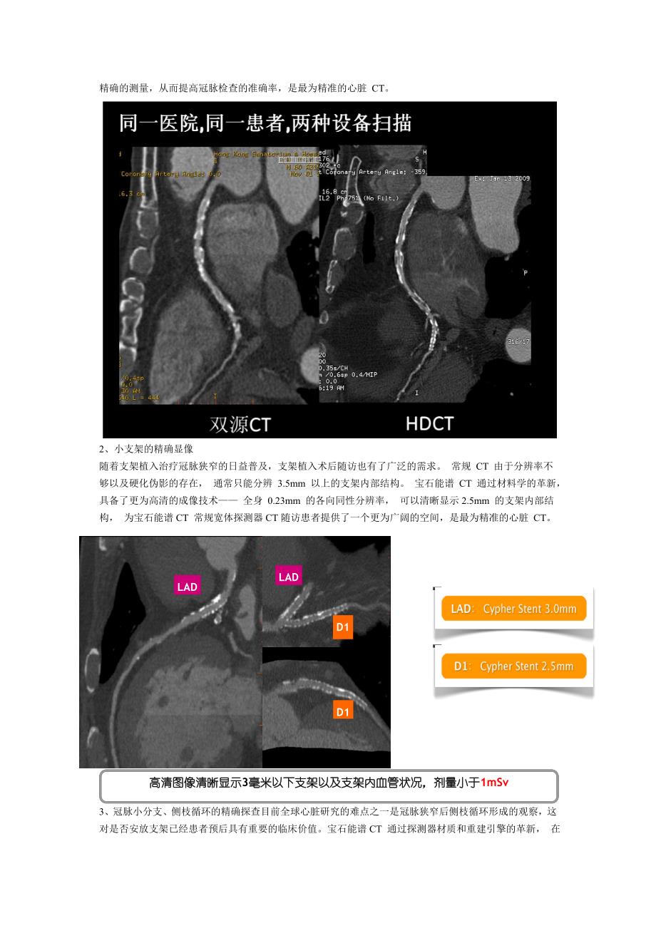 ge discovery ct750 hd 宝石能谱 ct_第4页