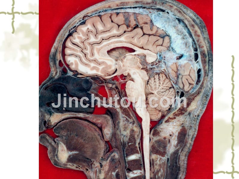 神经解剖图片2课件_第4页