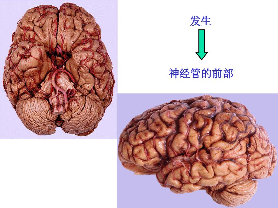 神经系统脑干_第2页