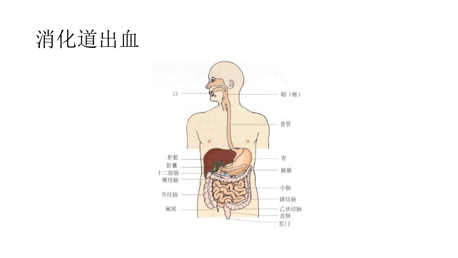 绪论及症状学第四章第十一节呕血_第3页