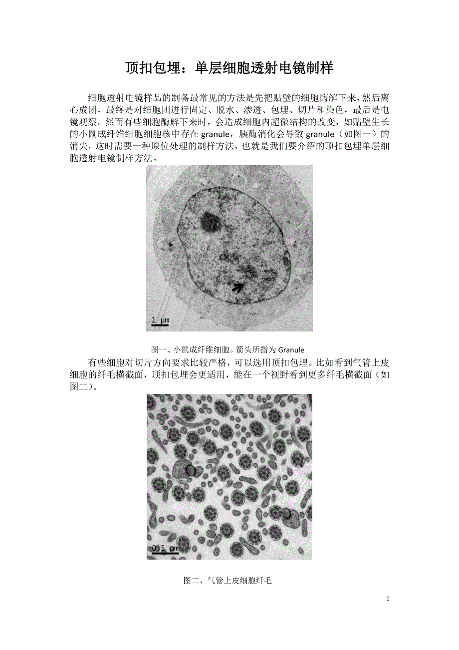 顶扣包埋：单层细胞透射电镜制样_第1页