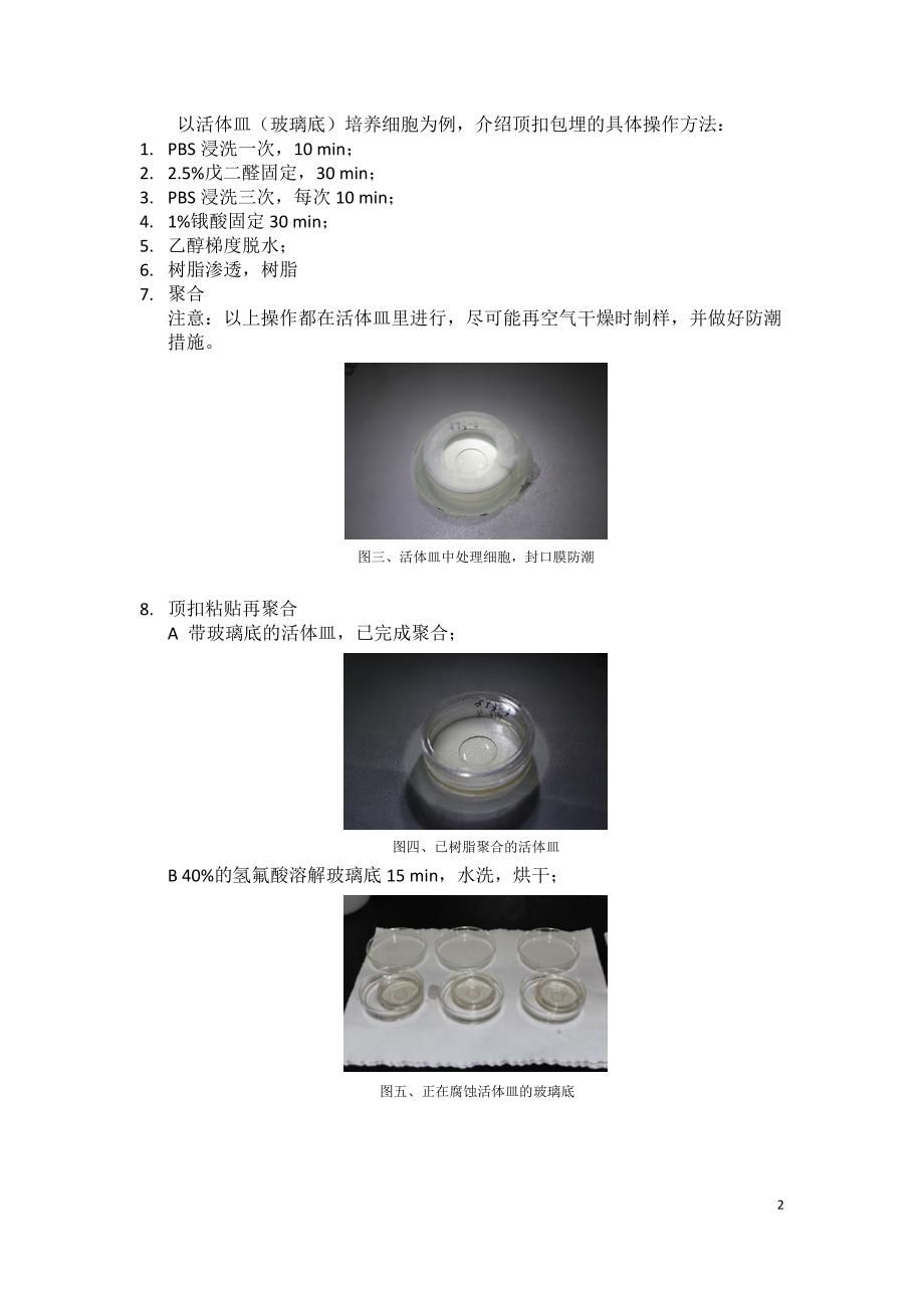 顶扣包埋：单层细胞透射电镜制样_第2页