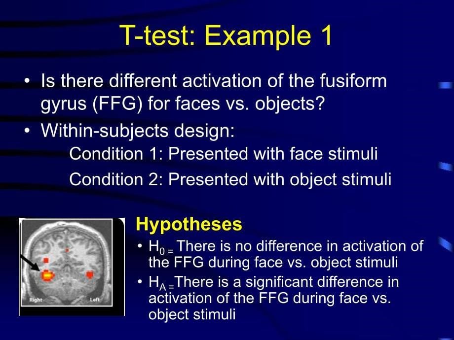 2017暑期班课件Lecture8-AnalysisMethodsforfMRIdata-2017Jan10章节_第5页