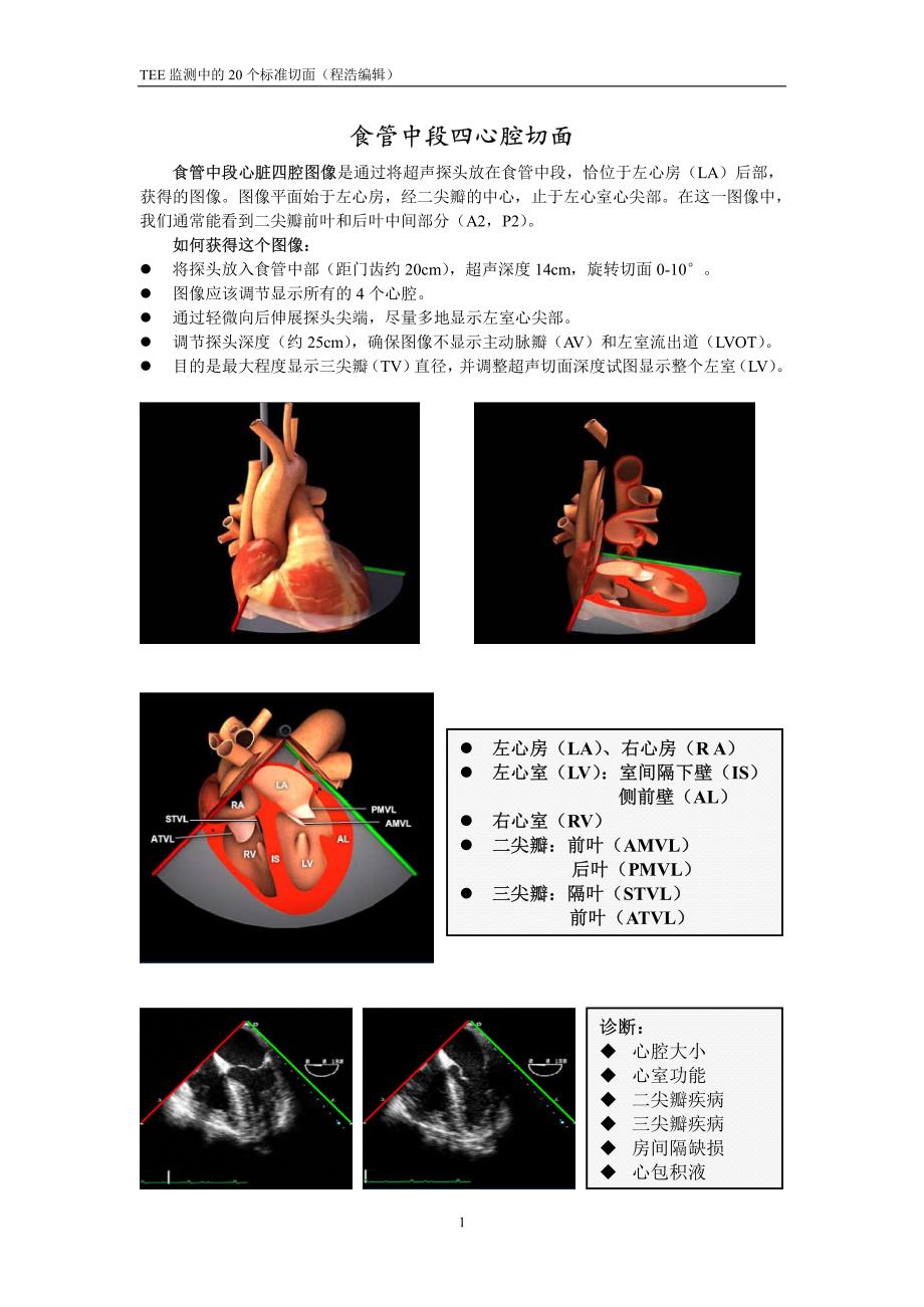 TEE监测中的20个标准切面_第1页