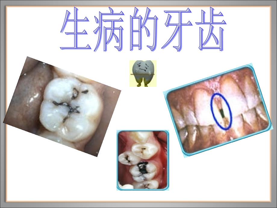 幼儿园保护牙齿课件(1)_第4页