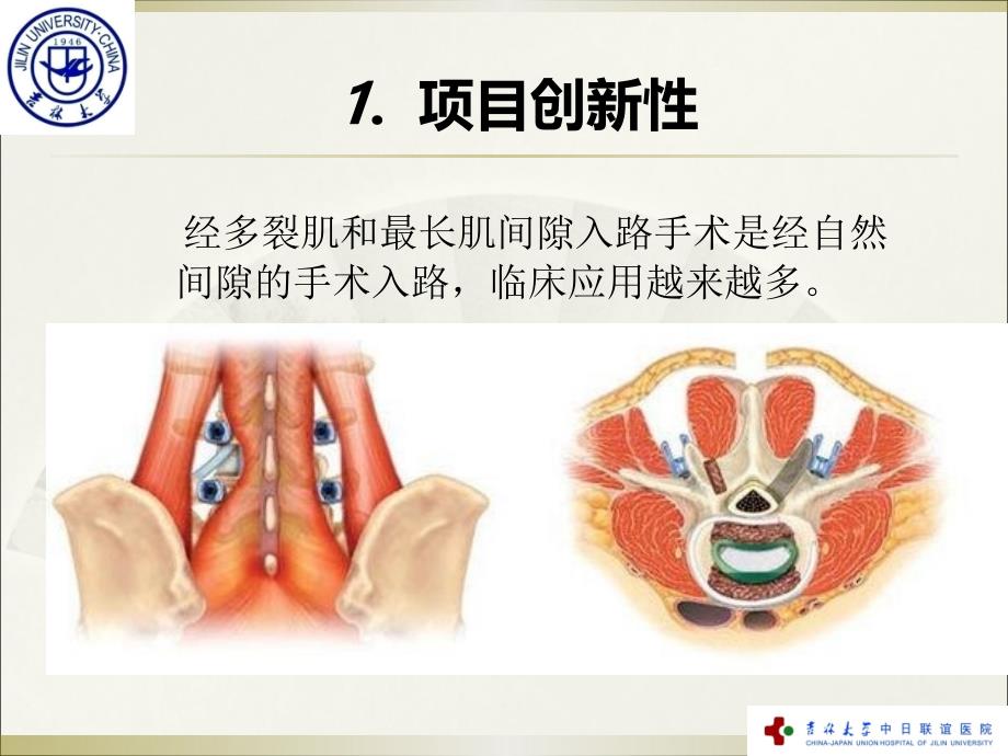 微创经椎间孔入路椎间融合术MISTLIF在治疗多种类型腰椎滑脱症中的应用课件_第4页