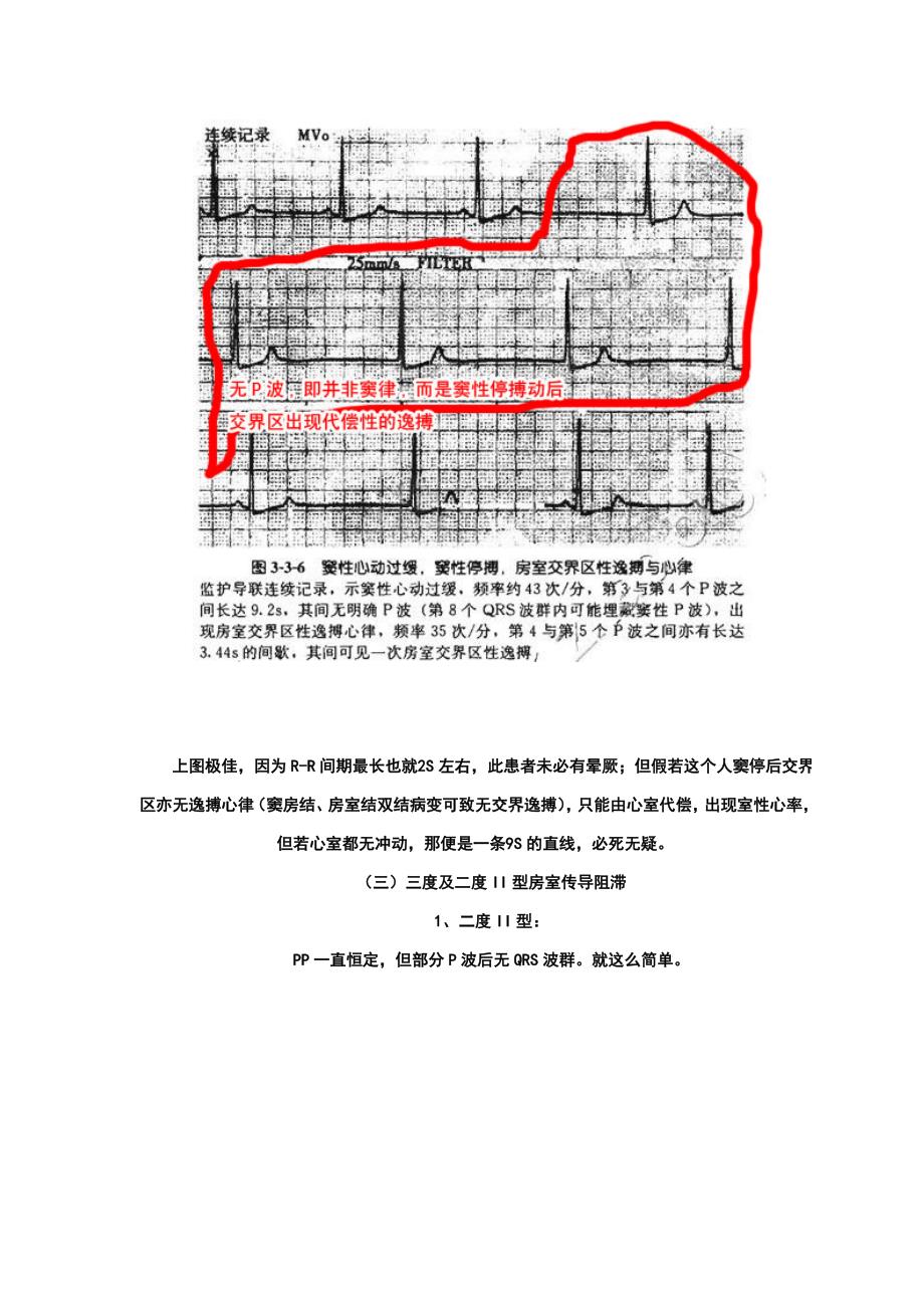 30分钟教你学会看心电图.doc_第2页