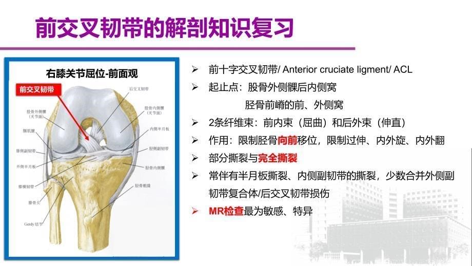 segond骨折与前交叉韧带损伤的影像学表现_第5页