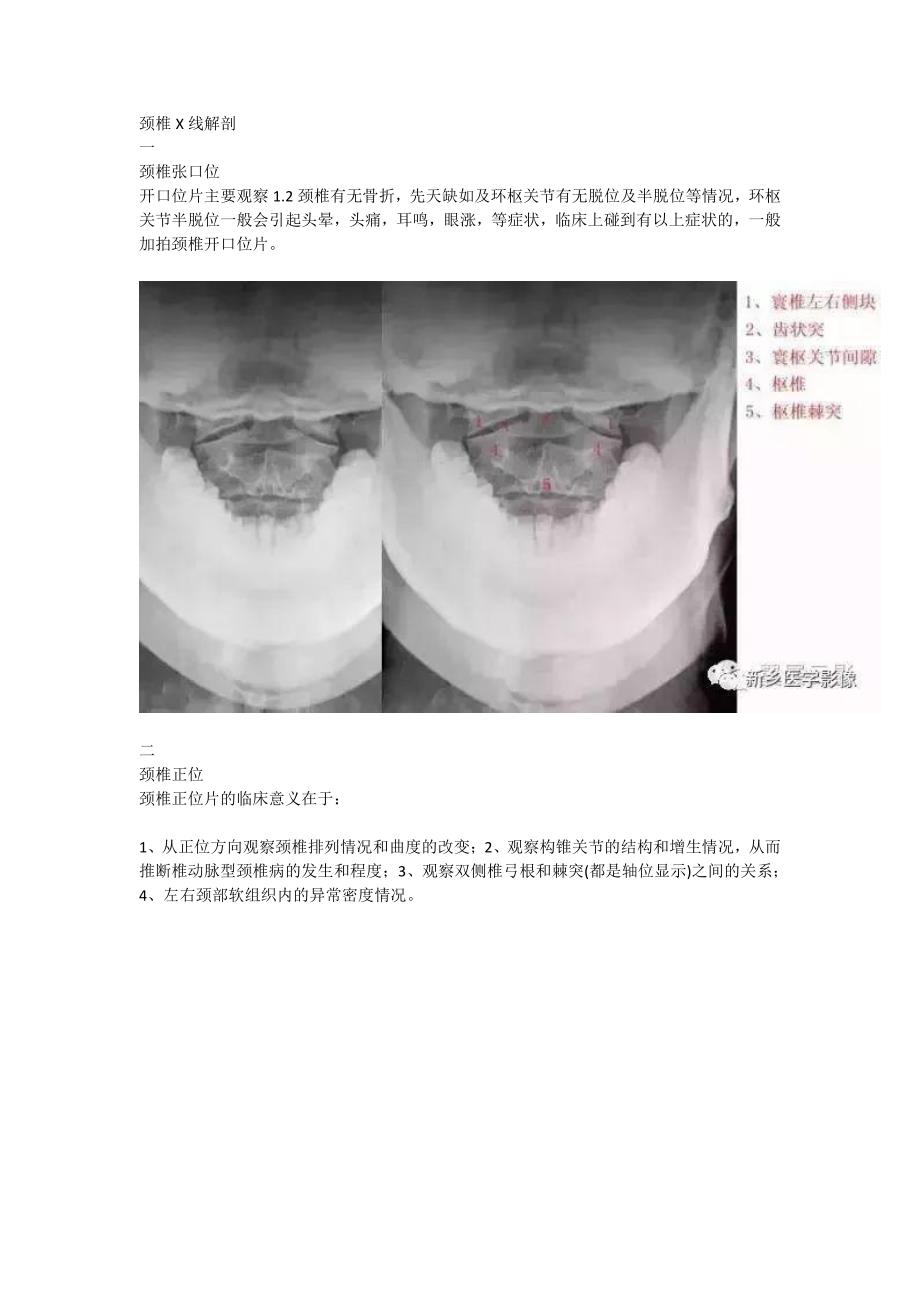颈椎X线解剖与解读.pdf_第1页