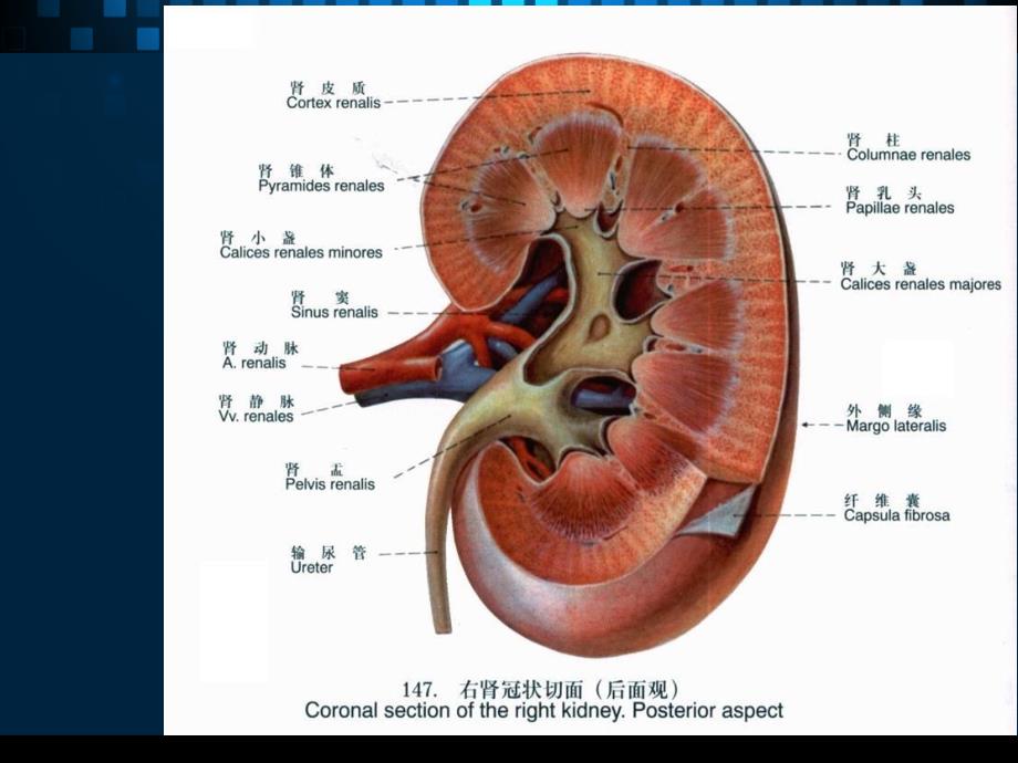 髓质海绵肾的影像诊断课件_第3页