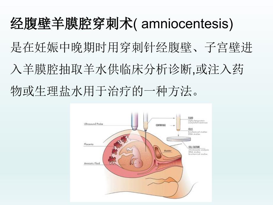 妇产科--常用小手术课件_第2页