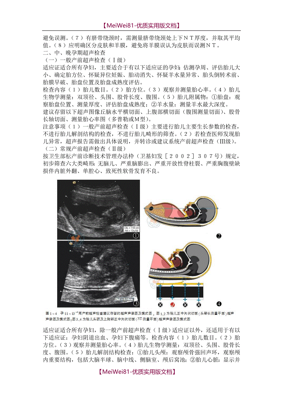 【8A版】产前超声检查指南_第3页