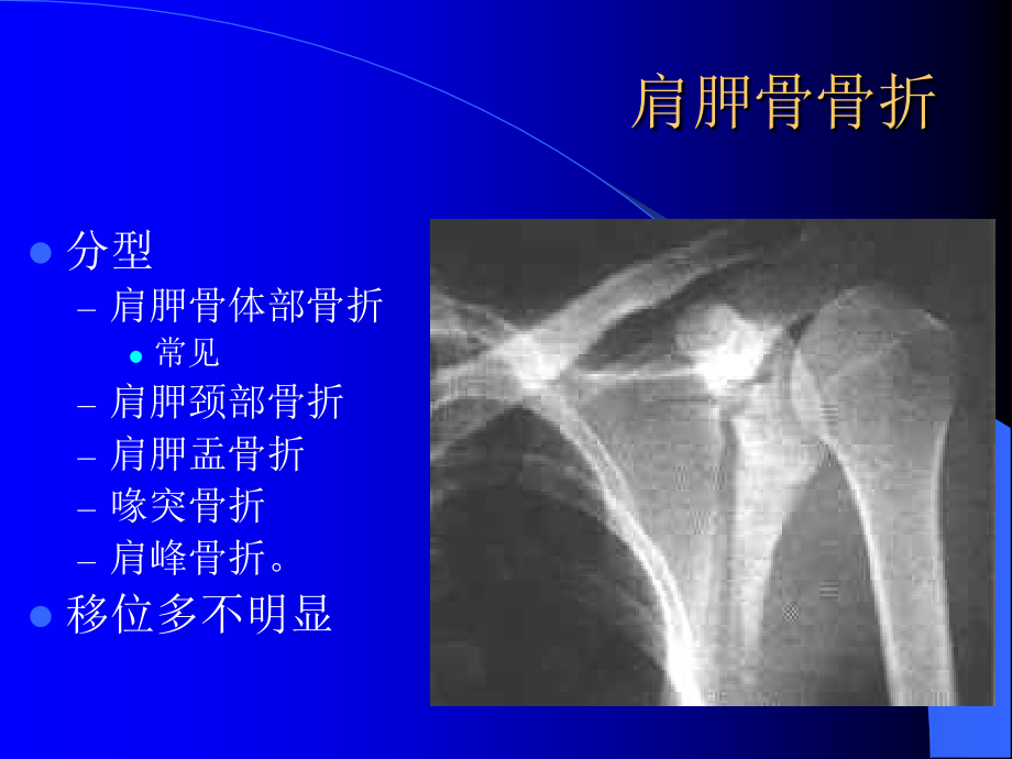 骨科常见疾病医疗管理知识分析_第4页