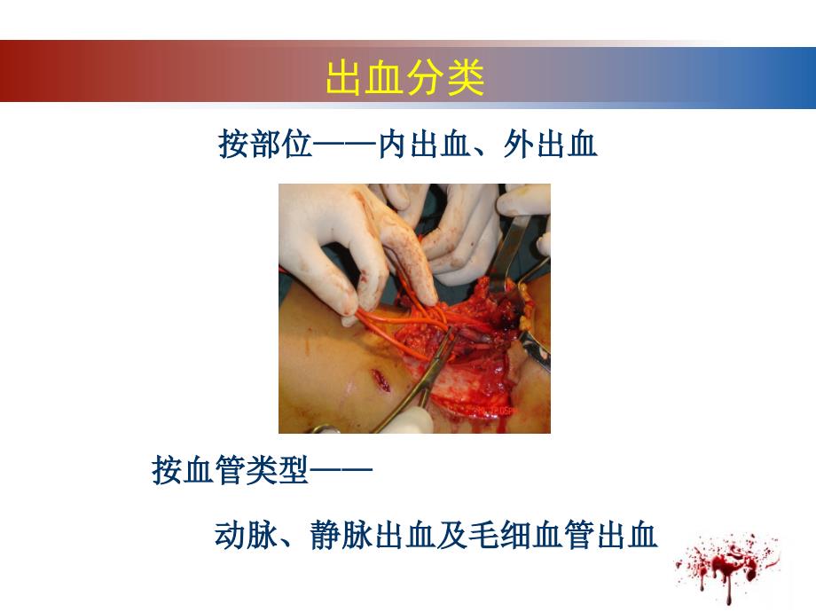 止血包扎(教学)_第3页