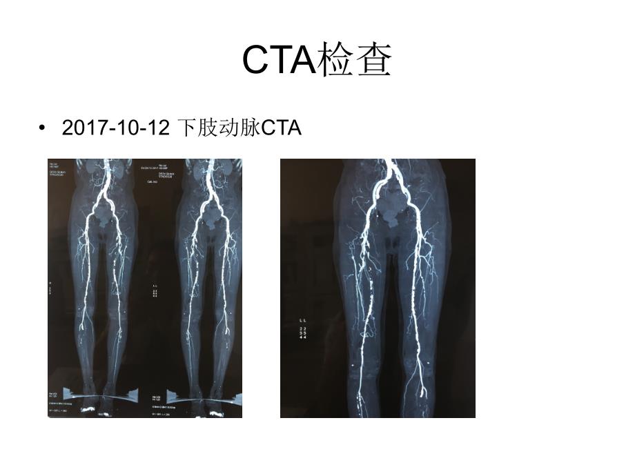 病例模板_第4页