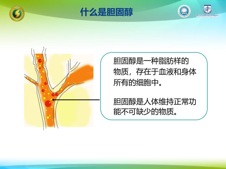 胆固醇与动脉粥样硬化-立普妥_第3页