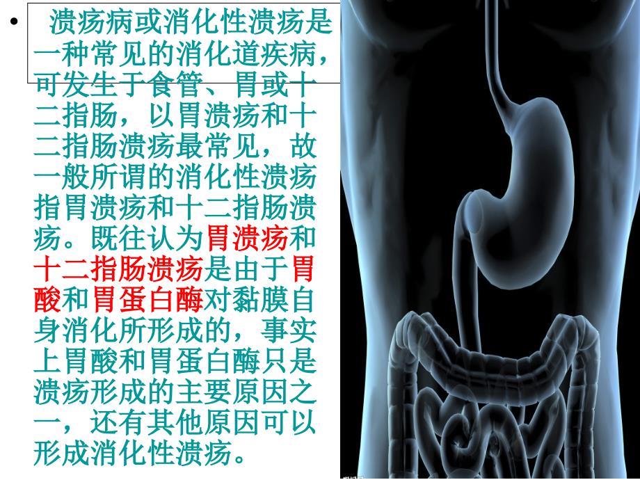 从胃的损伤与保护谈溃疡的形成与治疗_第4页