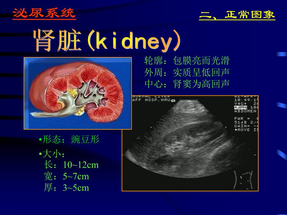 泌尿系统的超声诊断2_第3页