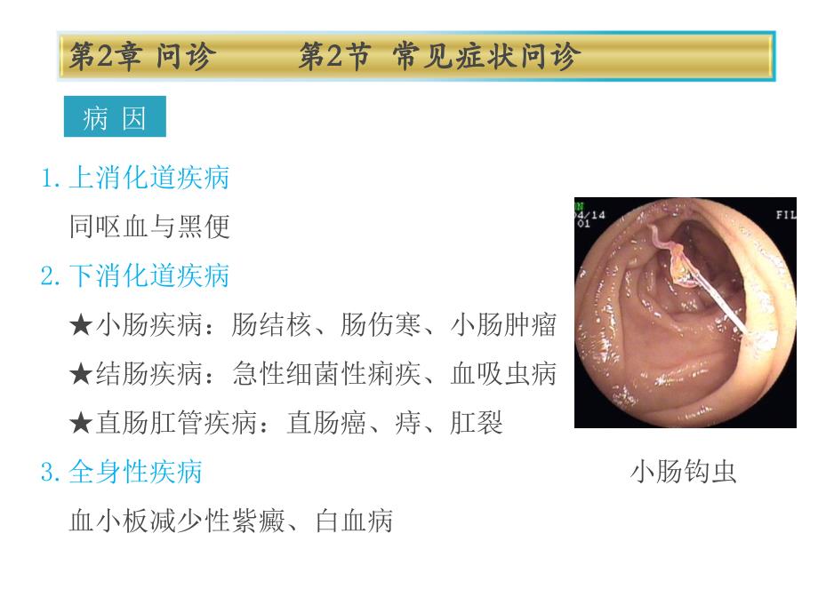 健康评估便血.ppt_第2页