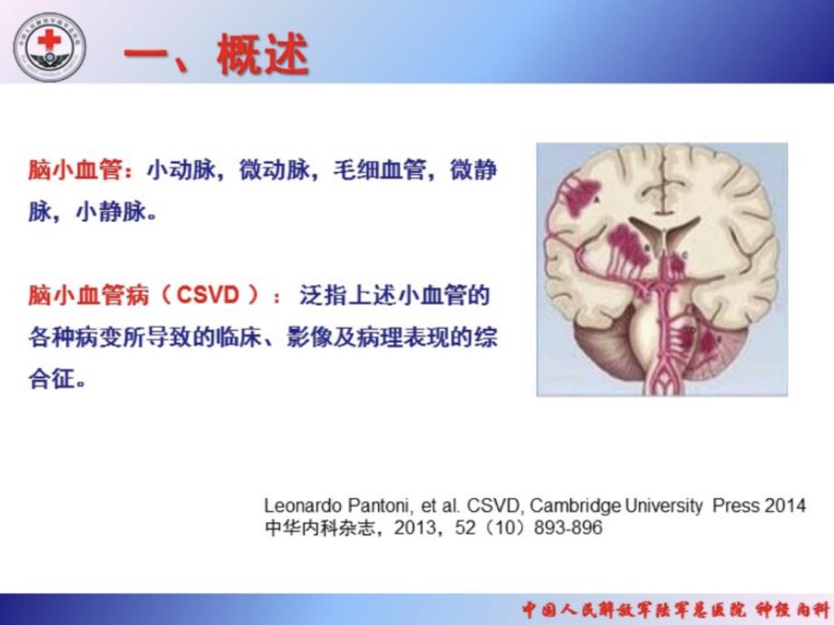 s50-脑小血管病基础研究进展_第4页