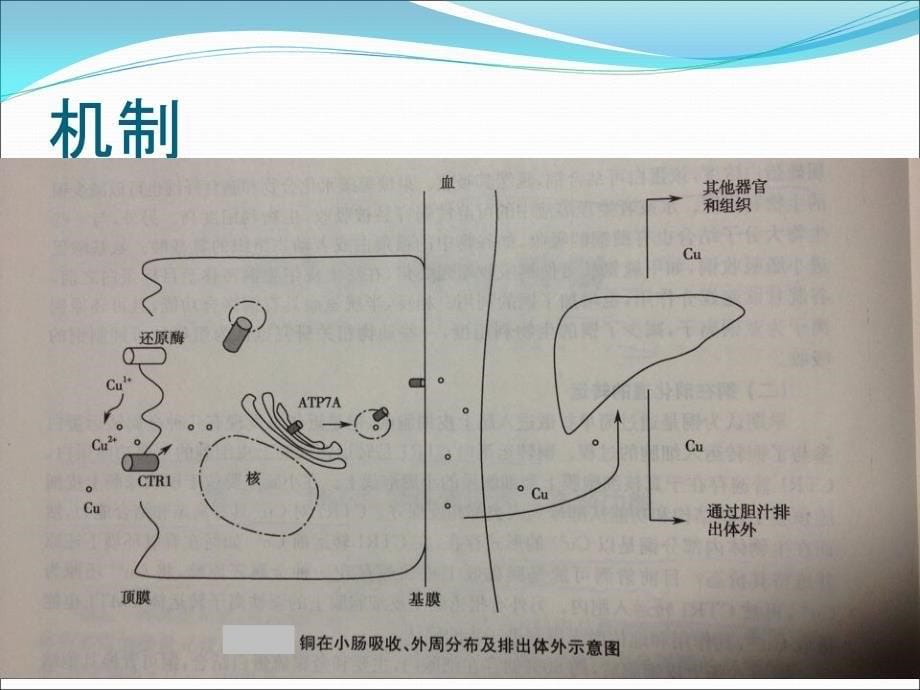 肝豆状核变性pp_第5页