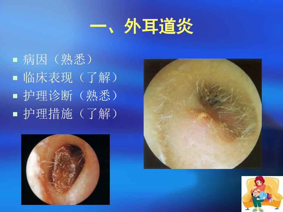 耳部常见疾病护理-常规_第3页