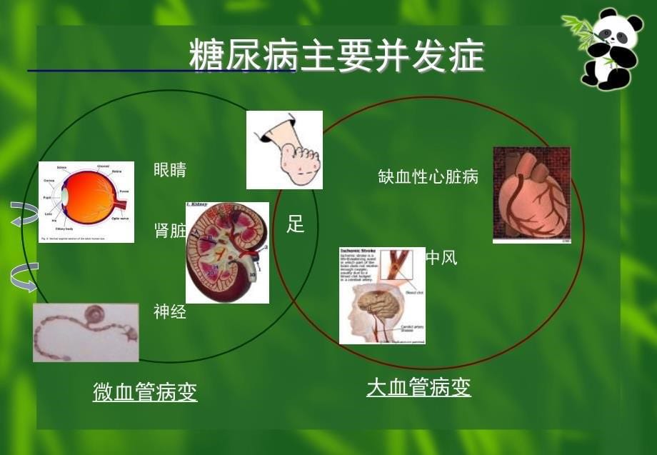 糖尿病饮食治疗宣教_第5页