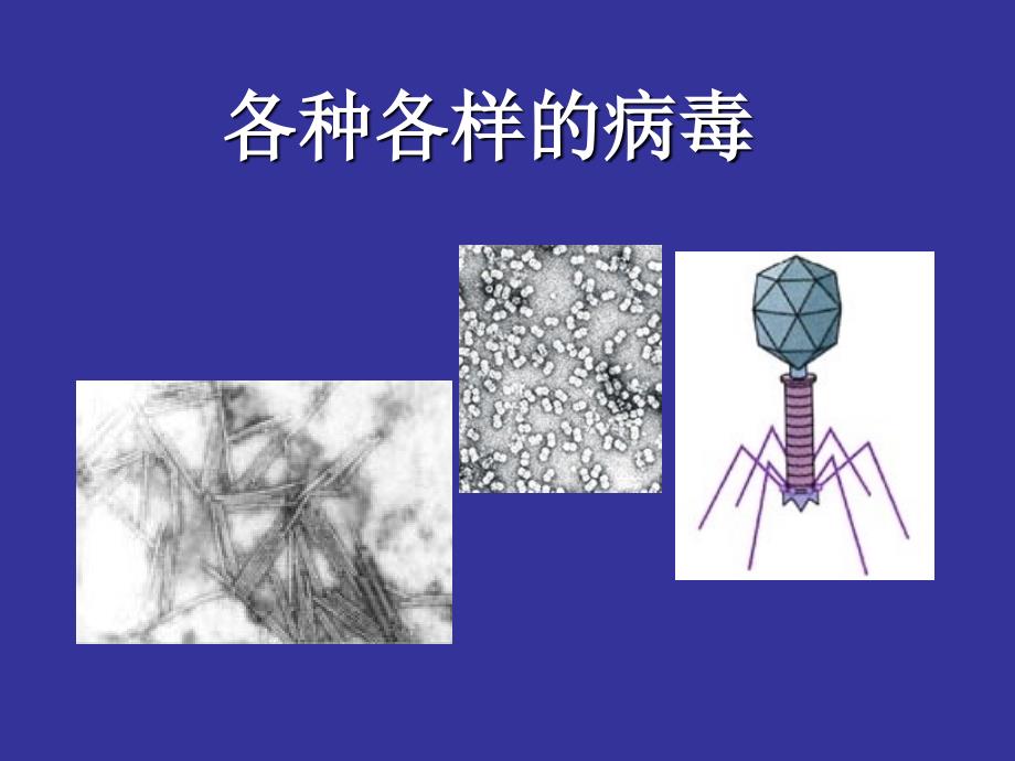 青岛版科学六年级上册病毒课程_第2页