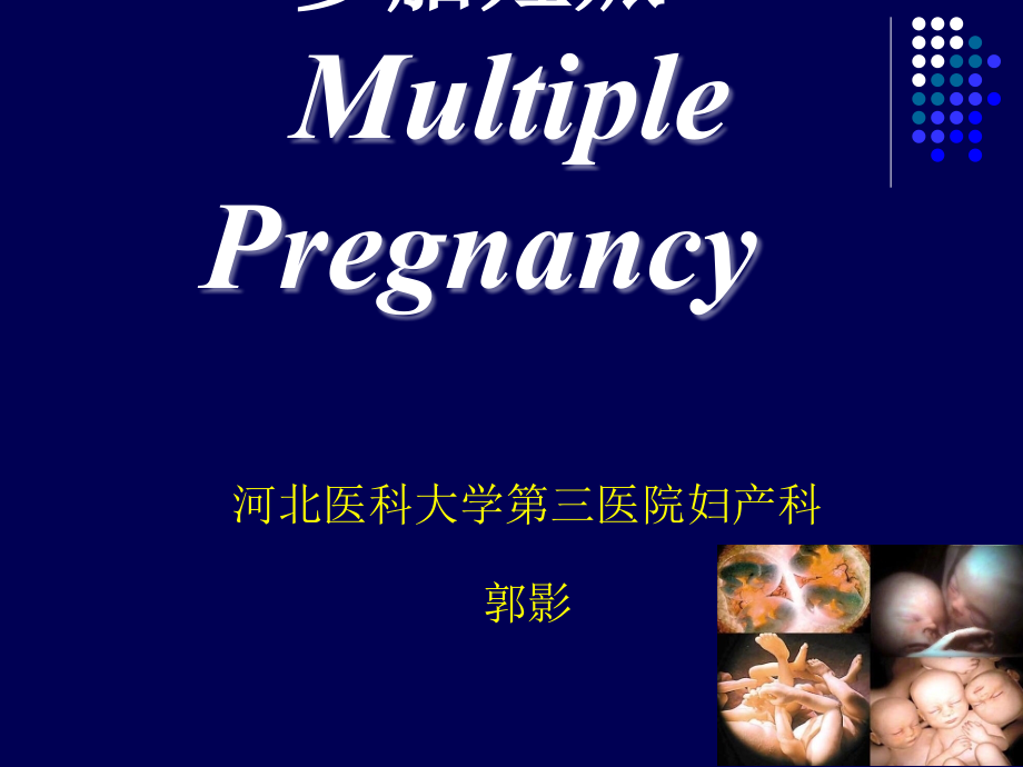 多胎妊娠2017_第1页