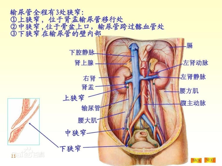 输尿管狭窄段切除与膀胱吻合术       手术配合_第4页