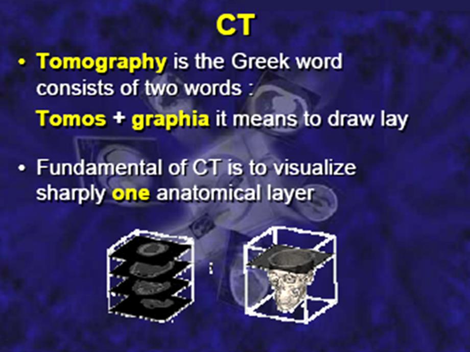 中国医科大学ct课件1_第4页