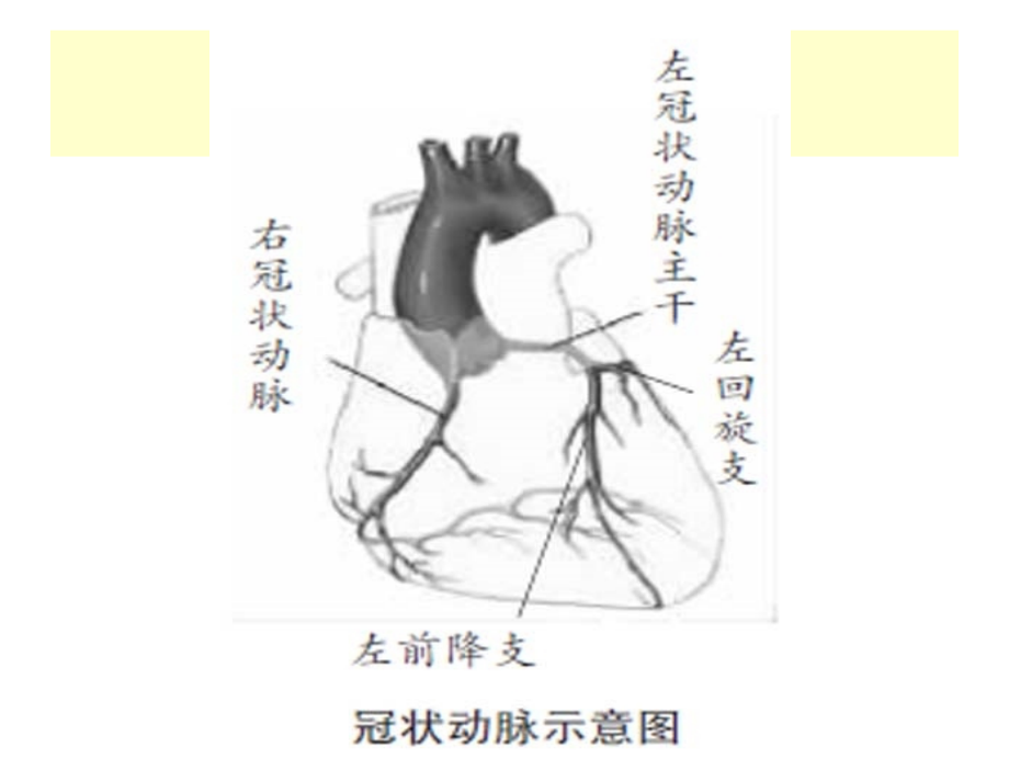 急性心肌梗死心电图与冠状动脉造影对应关系1_第4页