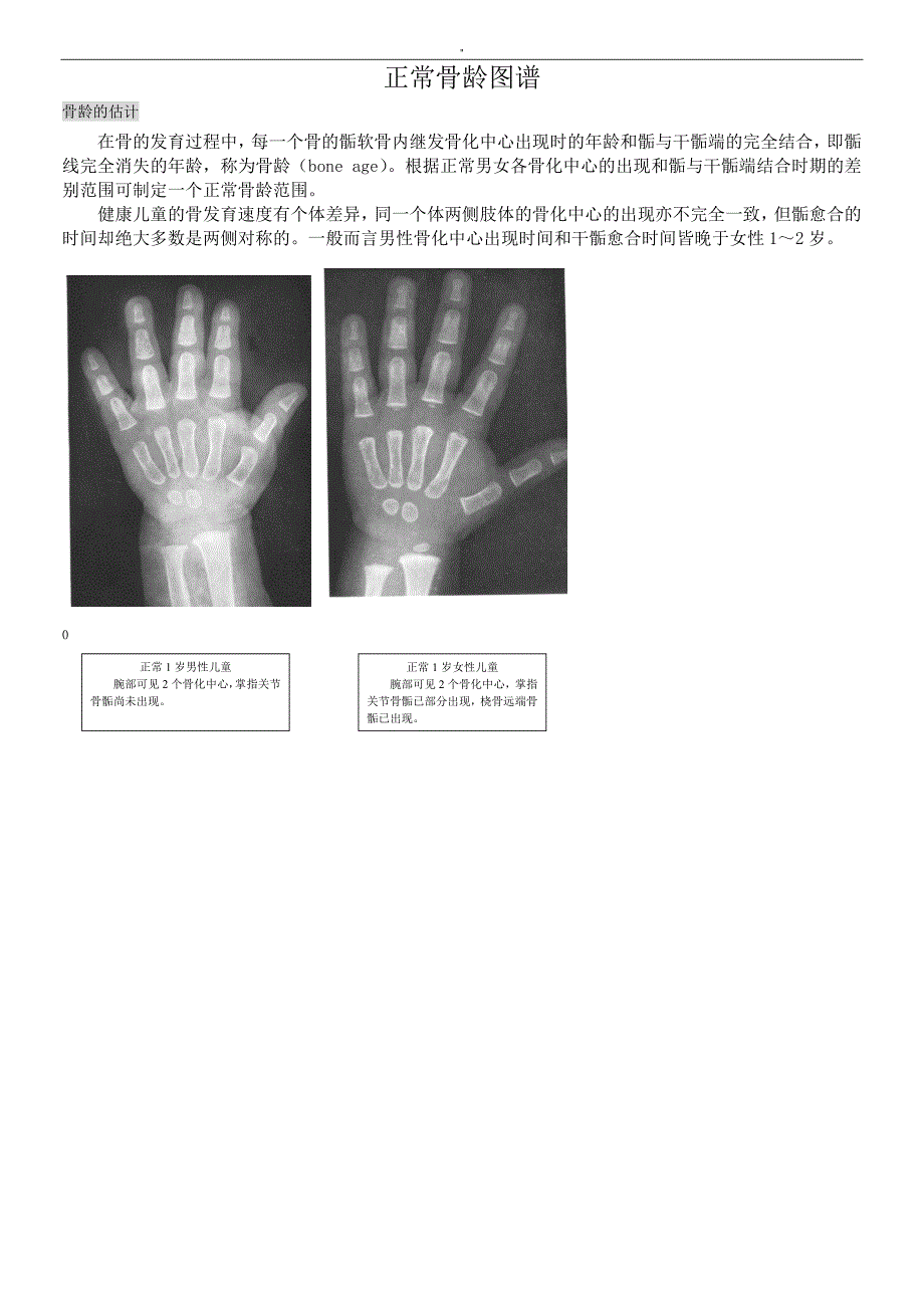 骨龄对照情况标准方案_第1页