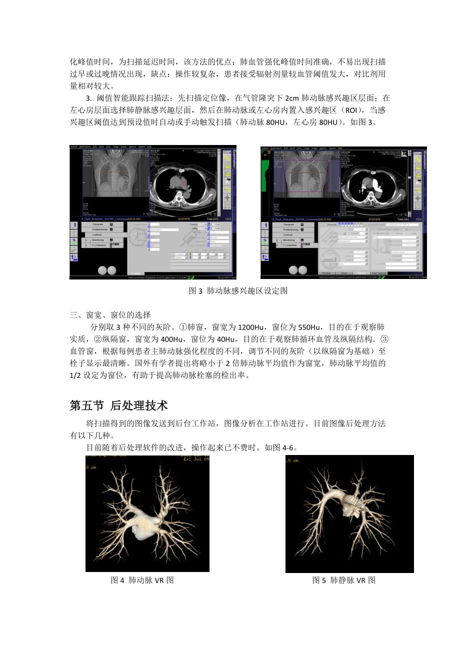 胸部血管cta成像技术_第4页
