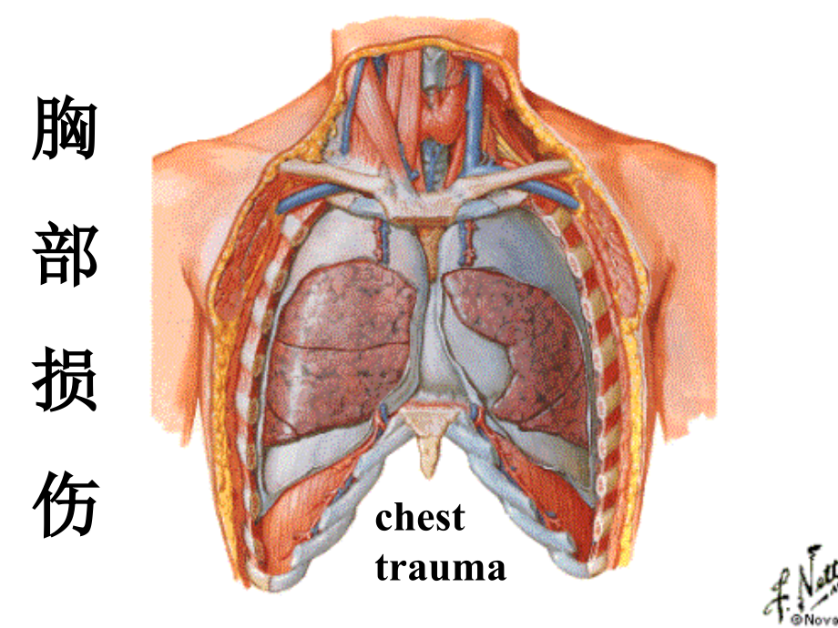 外科护理学课程-课件-12胸部损伤_第1页