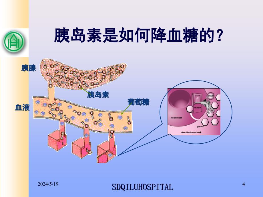 胰岛素患教2_第4页