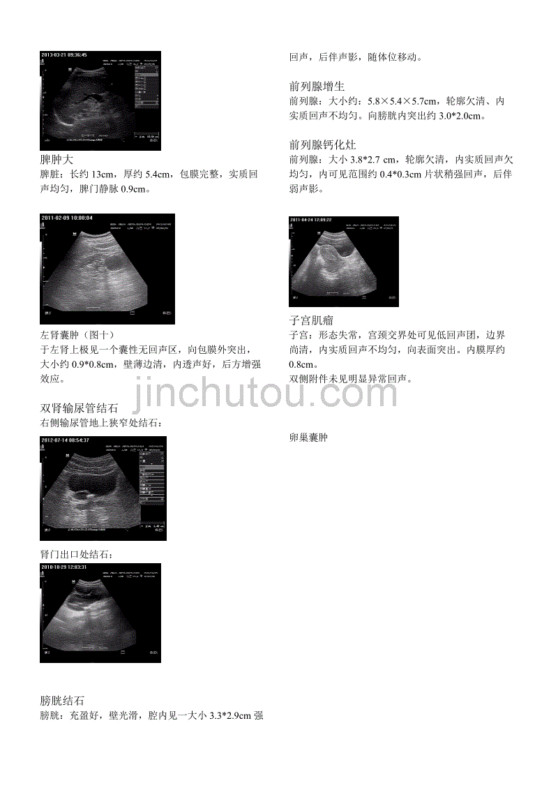 超声诊断报告描述及图片_第2页