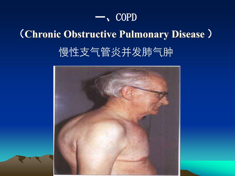 呼吸系统常见疾病的主要症状和体征(1)_第3页