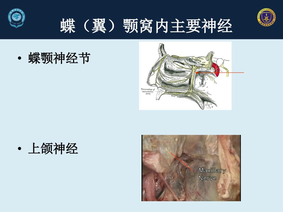 经蝶(翼)颚窝穿刺技术在头面痛中的应用-2013_第2页