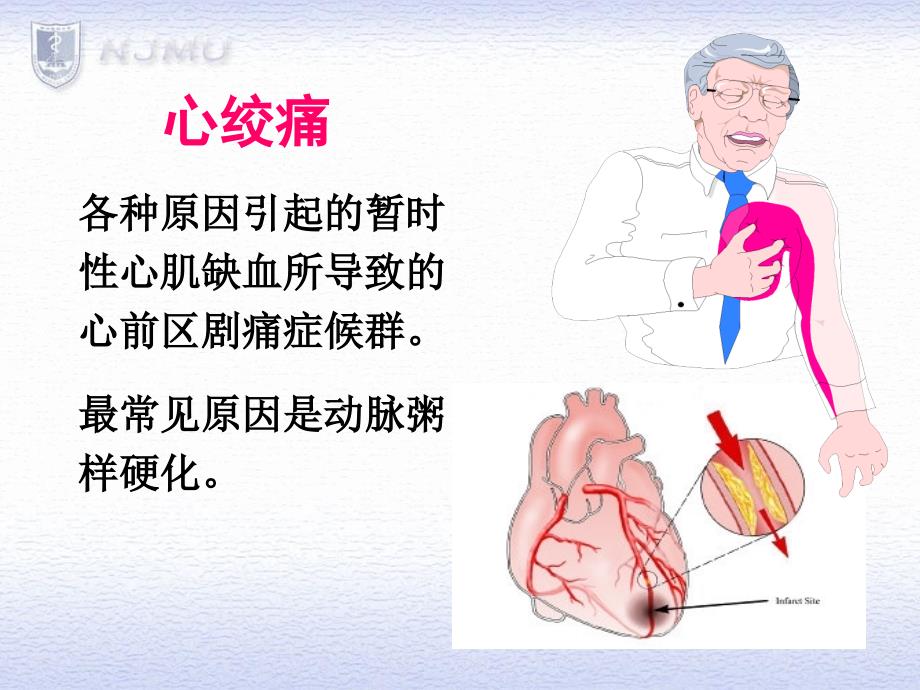 抗心绞痛药课件(1)_第2页