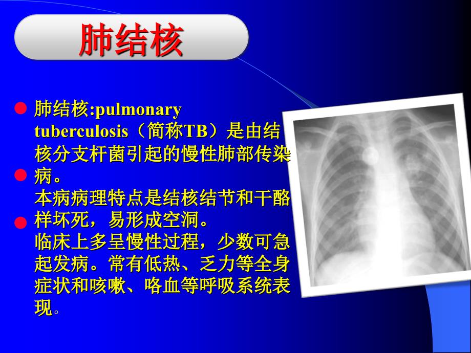 结核病(简明现代医学)_第3页