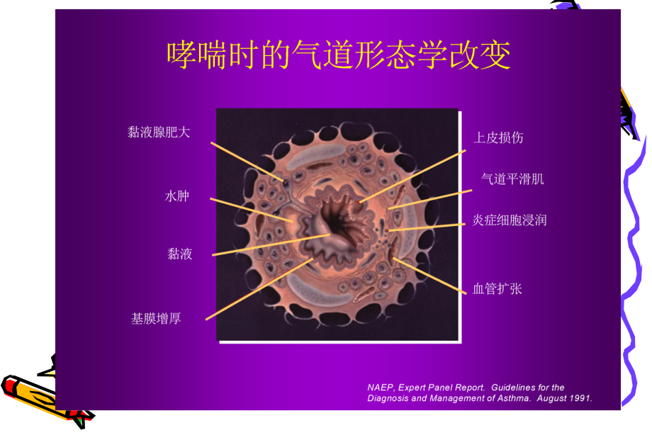 儿童医院小儿哮喘_第3页