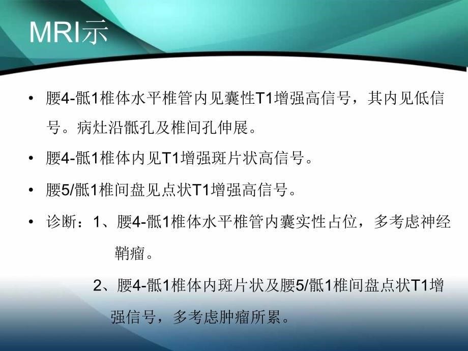 炎性肌纤维母细胞瘤ppt_第5页